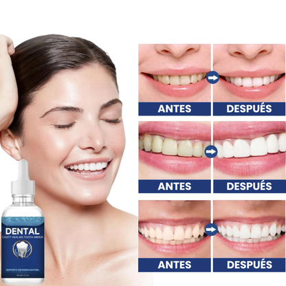 Lukka Tooth Armor – Sella y protege el esmalte